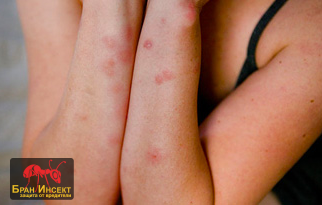 Как да убиете креватните дървеници и яйцата им с температура? - Бран Инсект